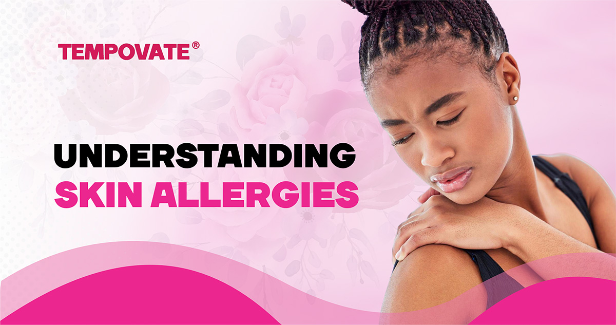 Understanding Skin Allergies